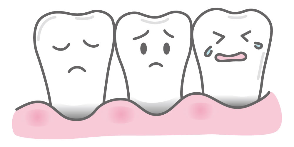 歯周病になりやすい人・悪化しやすい人の特徴について