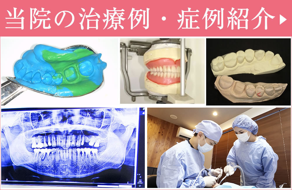 症例・治療例