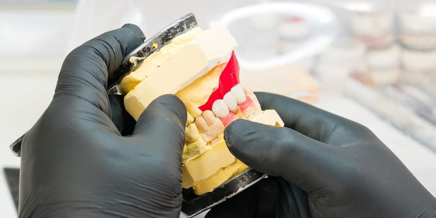 変形を最小限に抑える精密な「型採り」