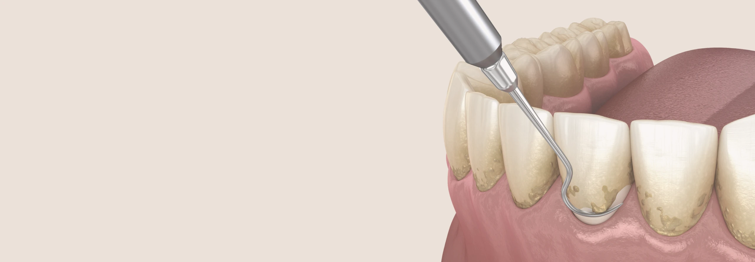 予防歯科