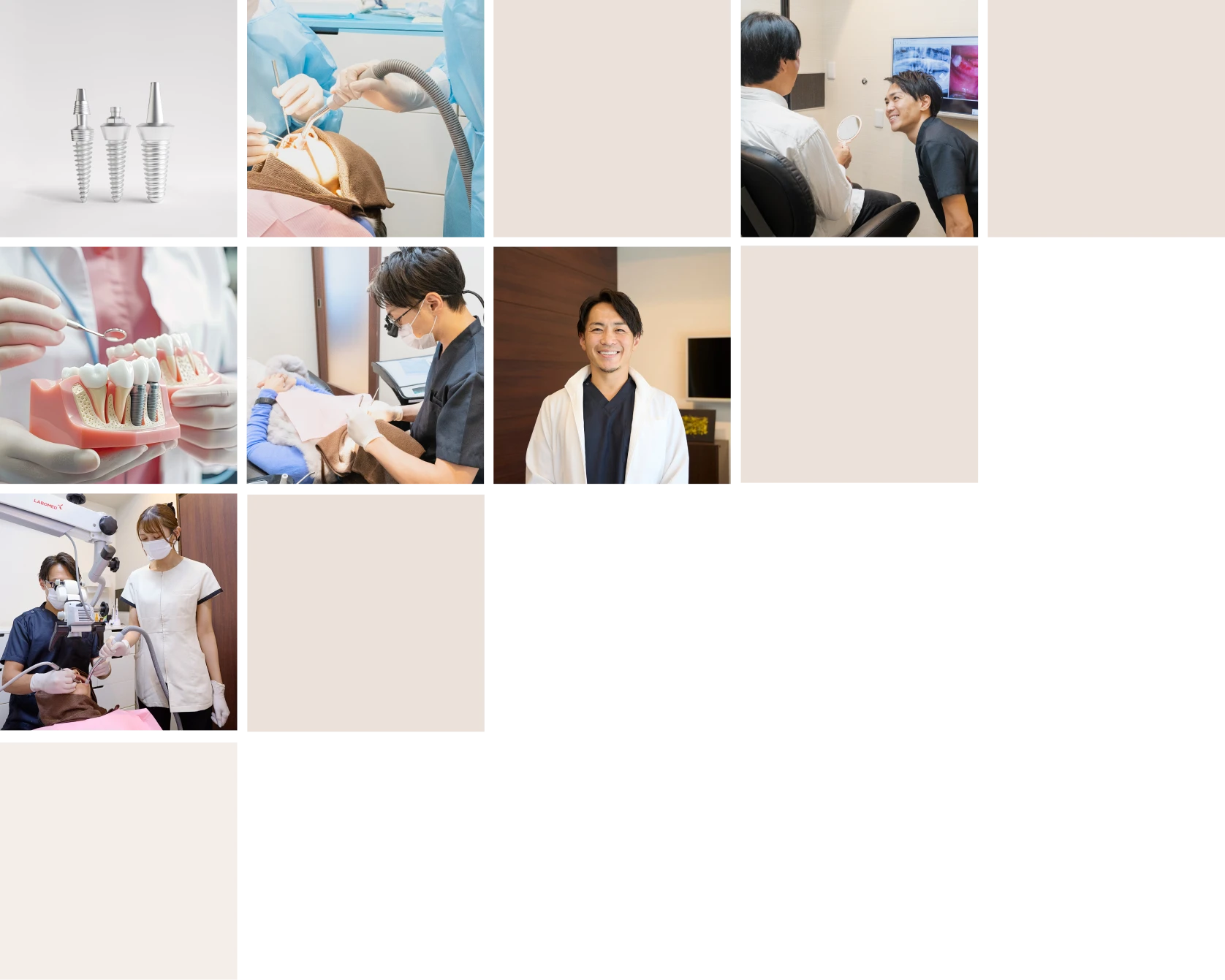 インプラント治療のイメージ