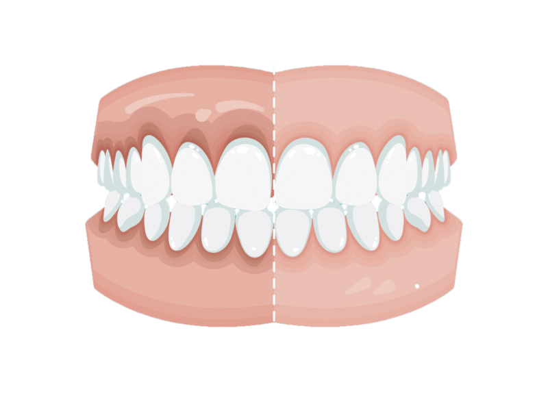 歯と同じくらい歯茎の色は顔の印象を左右します