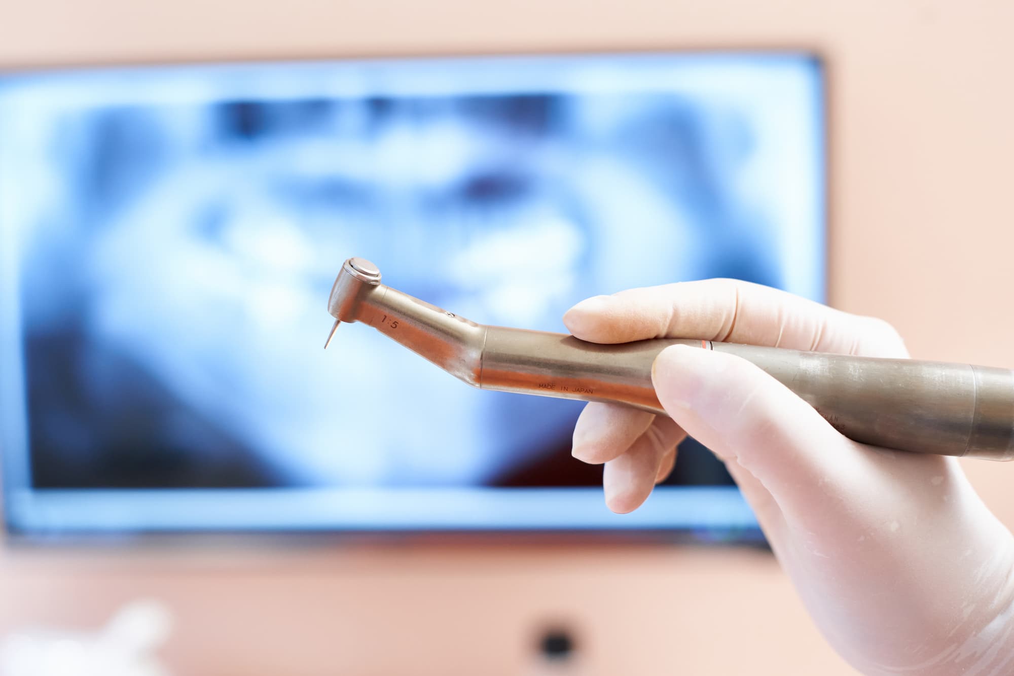 歯を削るタービンを持つグローブをした手