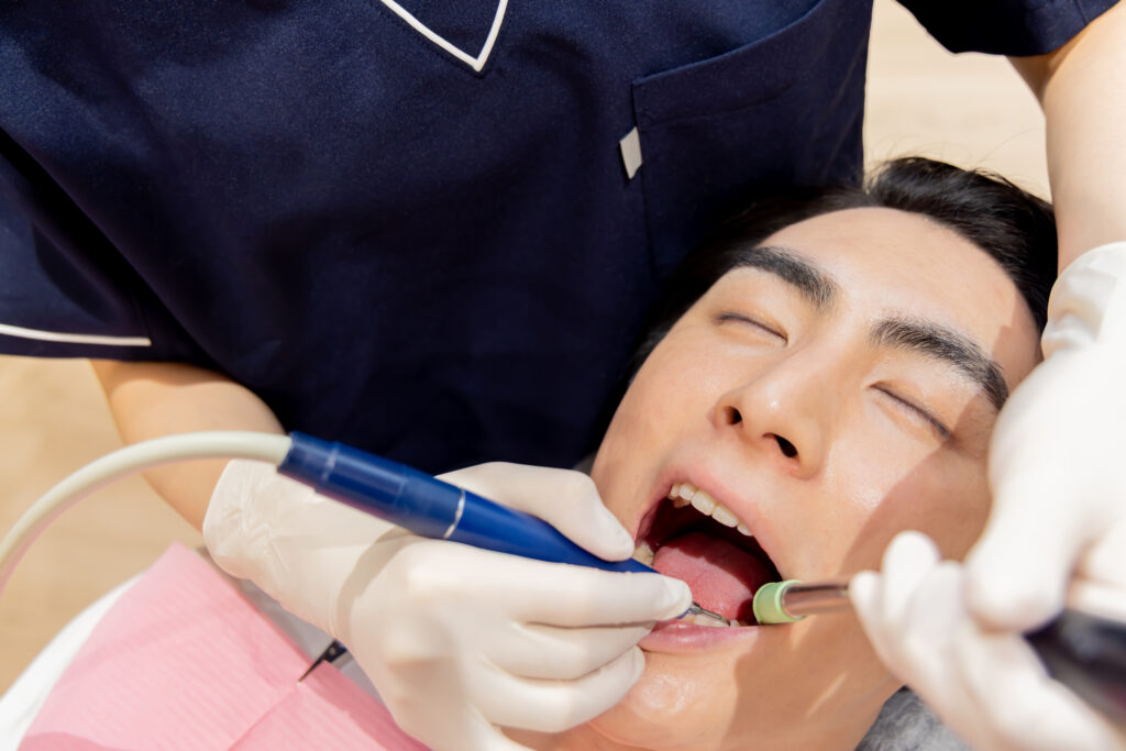 予防歯科の一環として、歯科医師にクリーニングをしてもらっている男性