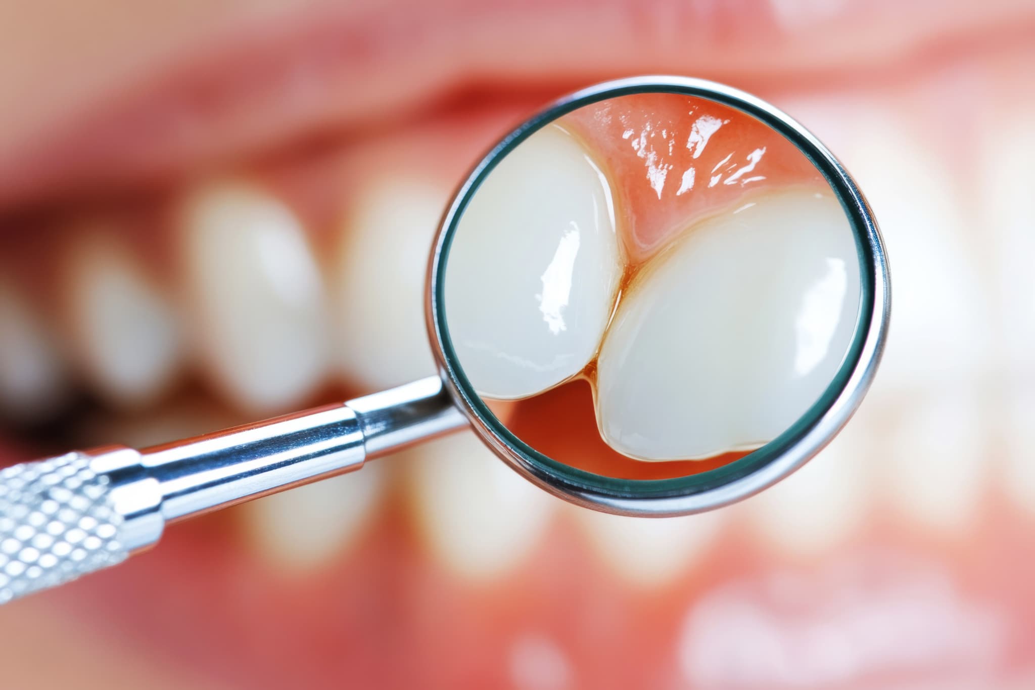 セラミックの隙間の汚れをチェックする様子